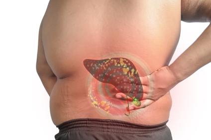How to Reverse Fatty Liver: Nutrition and Lifestyle Tips