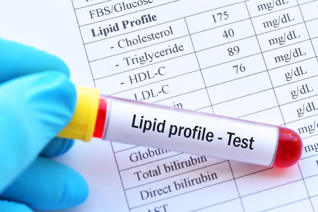 Lipid profile test