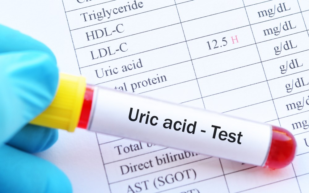 6 Tips to Lower Uric Acid Naturally