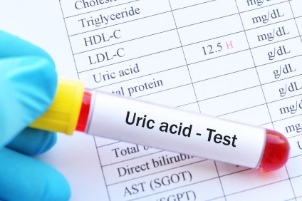 6 Tips to Lower Uric Acid Naturally