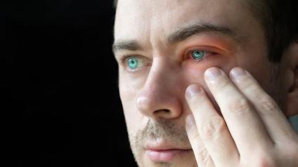 Colloidal Silver for Pink Eye - Conjunctivitis Remedy