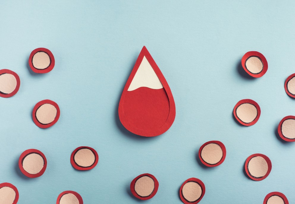 15 Signs You Are Iron Deficient