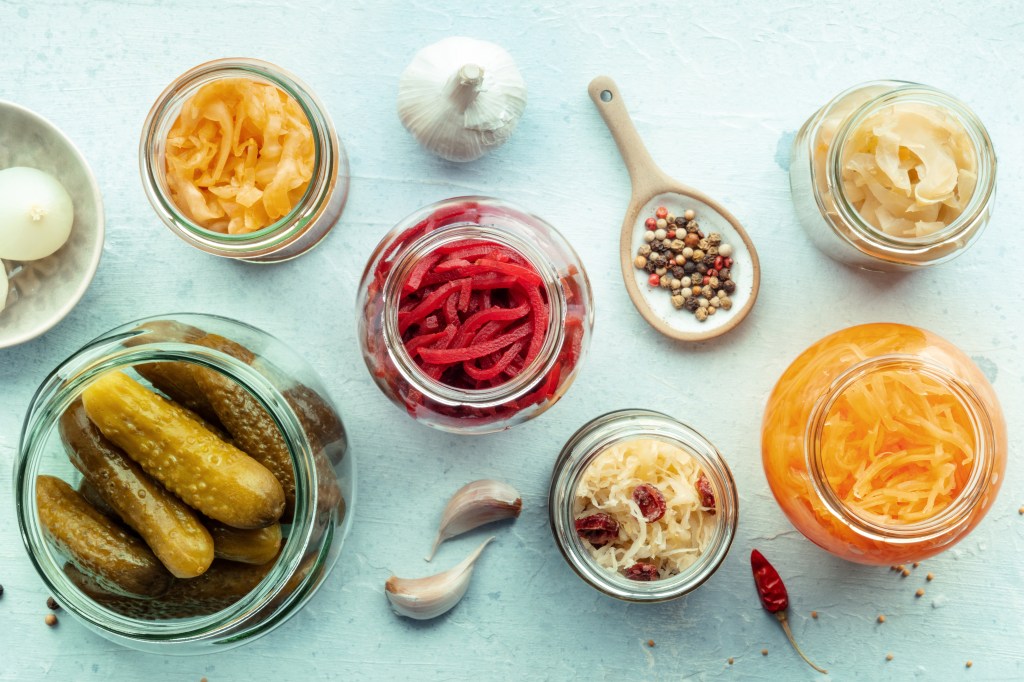 Assortment of fermented foods