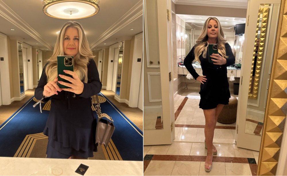 Reversing Liver Fibrosis: From Stage 3 to Stage 1