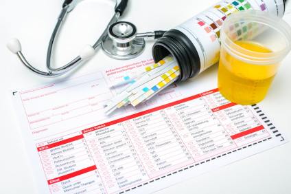 High Urine pH: Symptoms, Causes, and How to Test