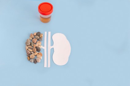 Can Vitamin K2 Dissolve Kidney Stones?