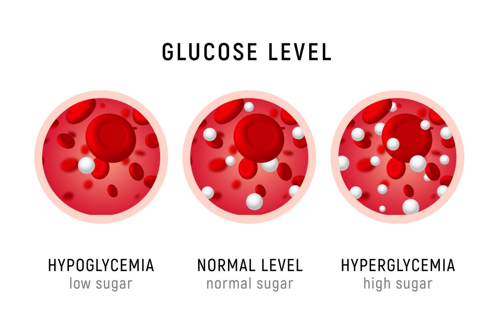 different blood sugar levels