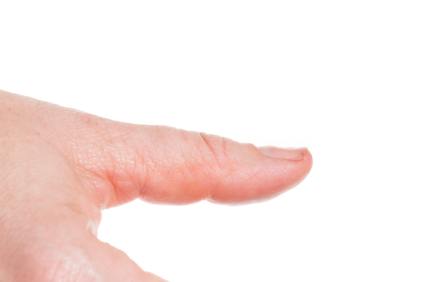 What Causes Spoon-Shaped Nails?