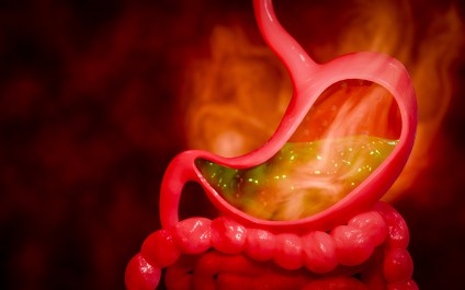 GERD Diet: What to Eat and Avoid for Acid Reflux Relief