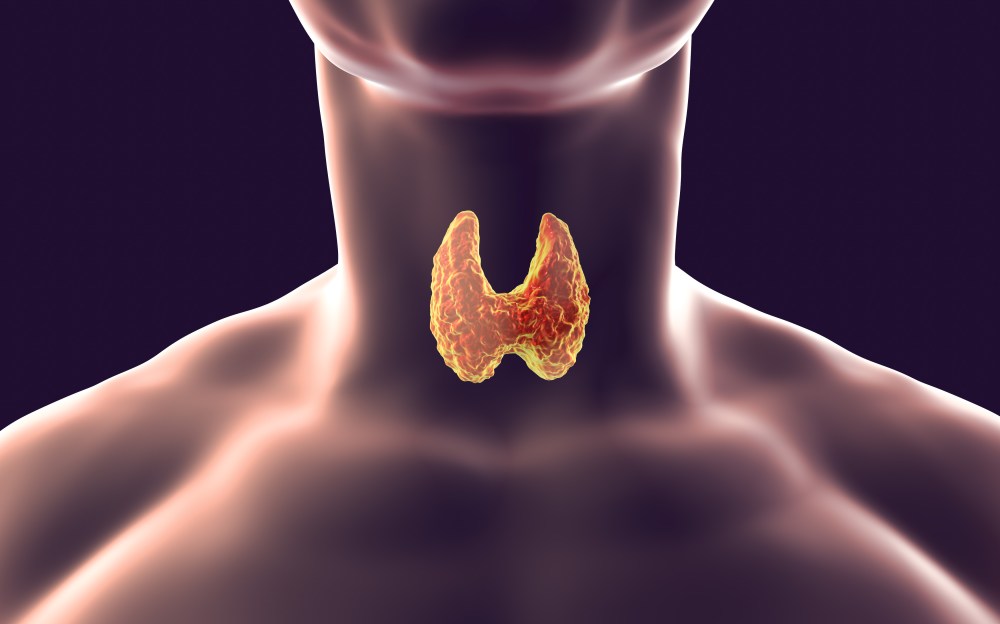 The Thyroid Body Type
