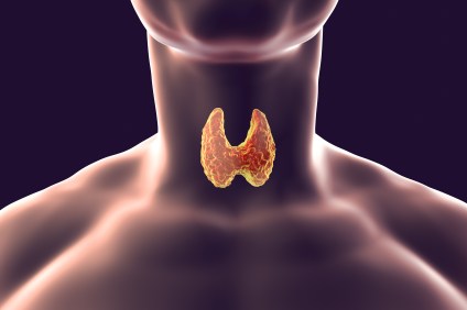 The Thyroid Body Type