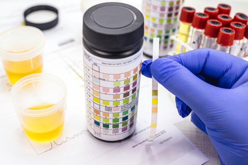 Urine test