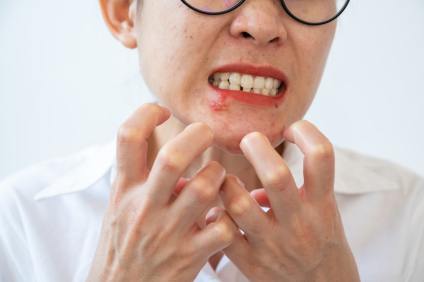 How to Starve Herpes: The Power of Fasting