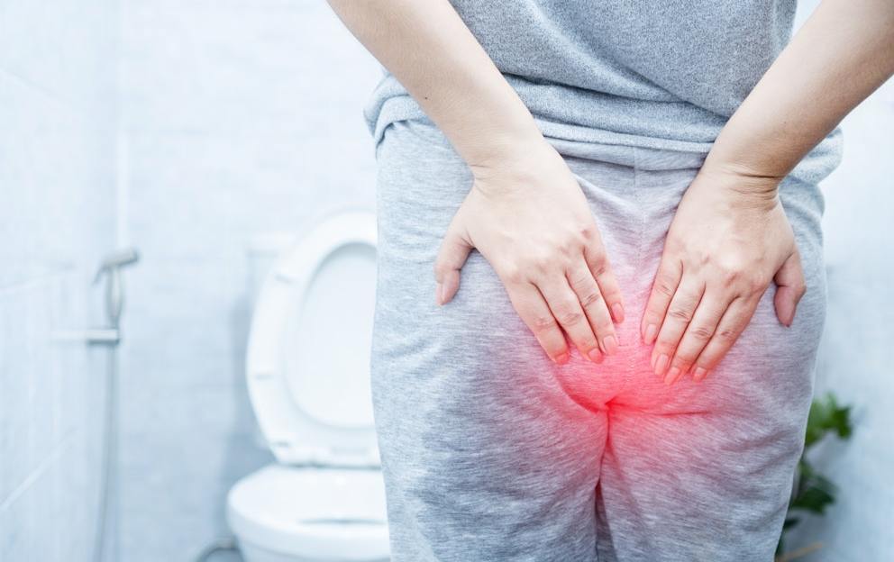 The Best Homeopathic Remedy for Hemorrhoids