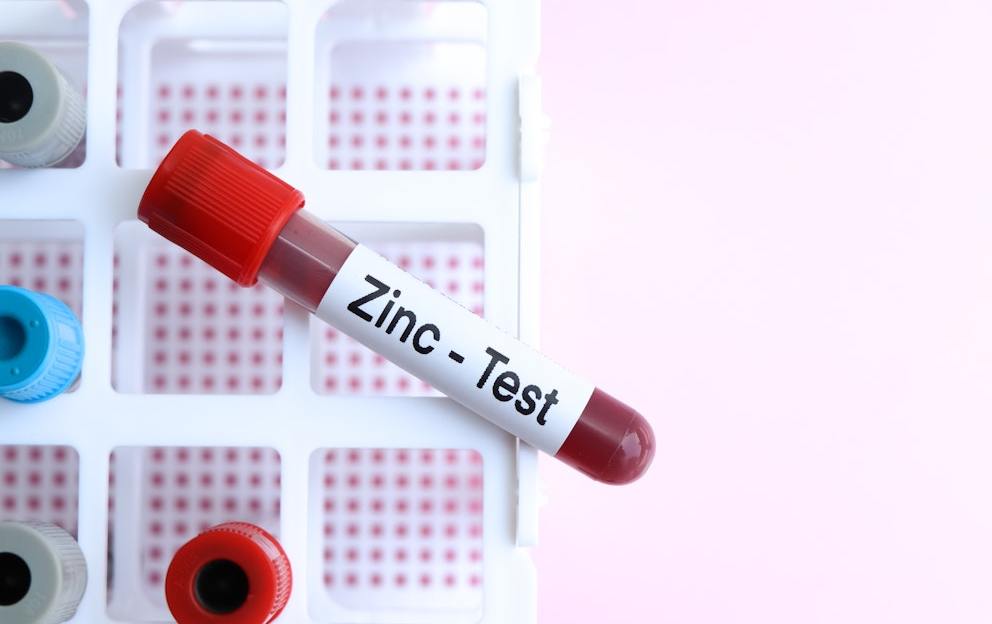 Zinc Toxicity: Are You Taking Too Much?