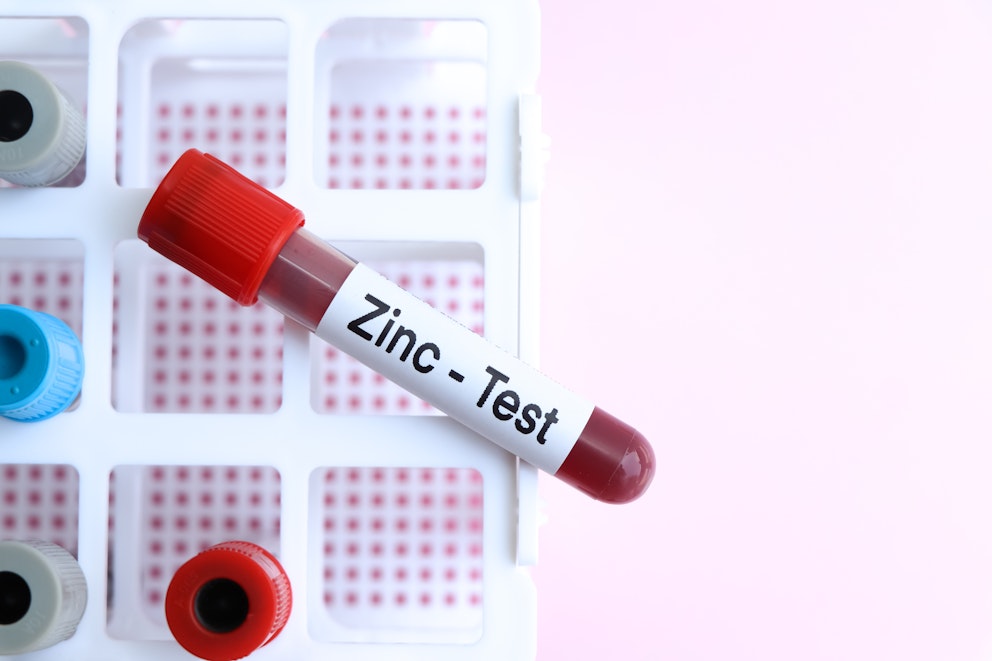 Zinc Toxicity: Are You Taking Too Much?