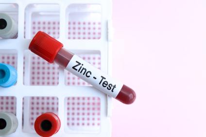 Zinc Toxicity: Are You Taking Too Much?